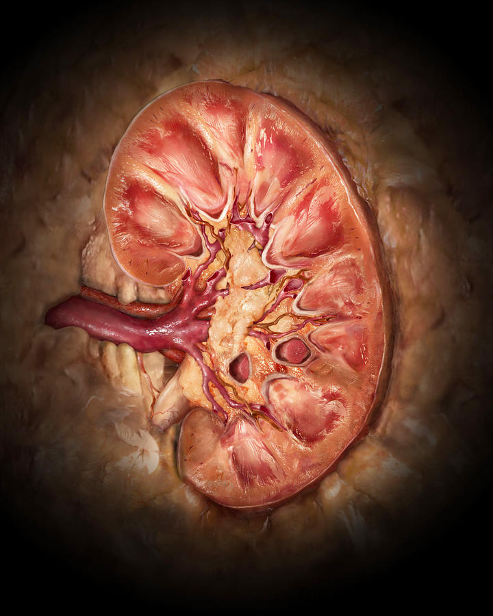 Healthy Kidney, Coronal Section Photograph by Anatomical Travelogue