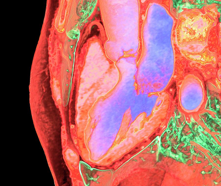 Heart And Left-hand Chambers Photograph by K H Fung/science Photo Library