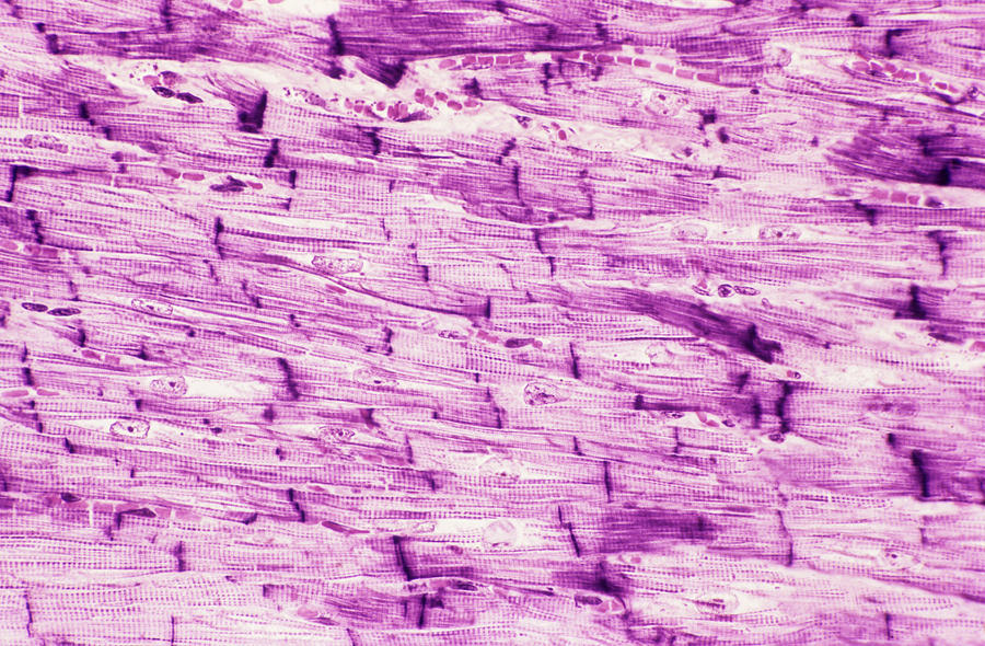 Heart Muscle Photograph by Astrid & Hanns-frieder Michler/science Photo ...