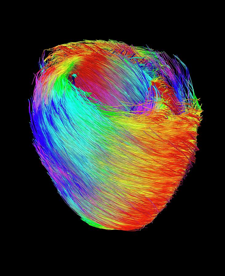 Heart Muscle Fibres Photograph by Ucl Cabi
