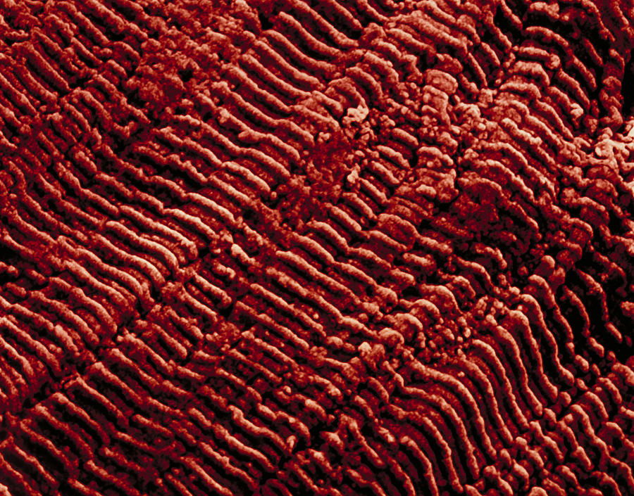 Heart Muscle Tissue Photograph by Dee Breger