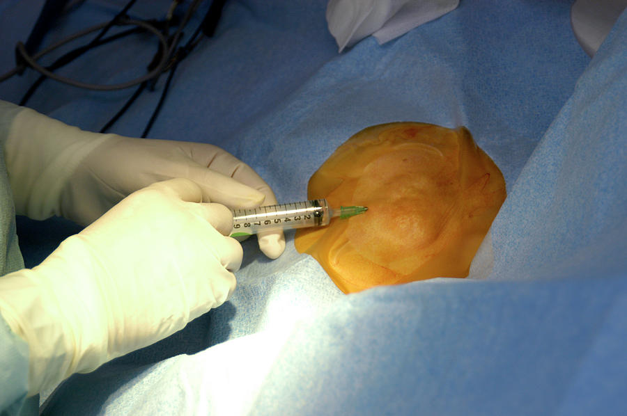 Heart Pacemaker Surgery Photograph by Aj Photo/science Photo Library