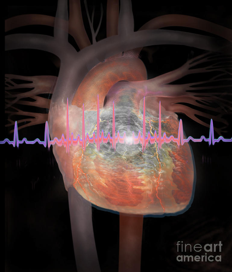 Heart With An Erratic Ekg Photograph by Jim Dowdalls