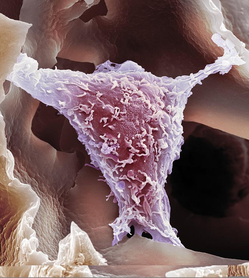Biological Photograph - HeLa cell, SEM by Science Photo Library