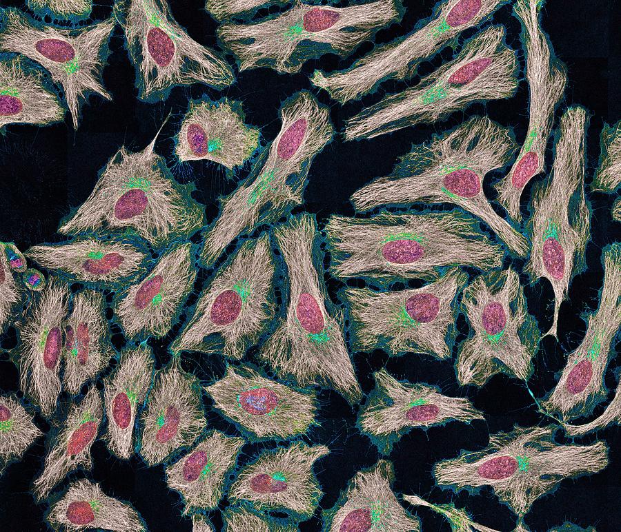Abnormal Photograph - HeLa cells, light micrograph by Science Photo Library