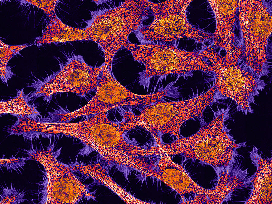 Hela Cells, Mfm Photograph by Science Source