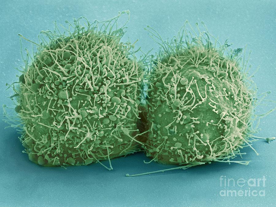 Hela Cells, Sem Photograph by National Institutes Of Health