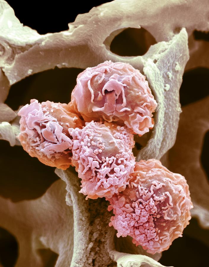 HeLa cells, SEM Photograph by Science Photo Library