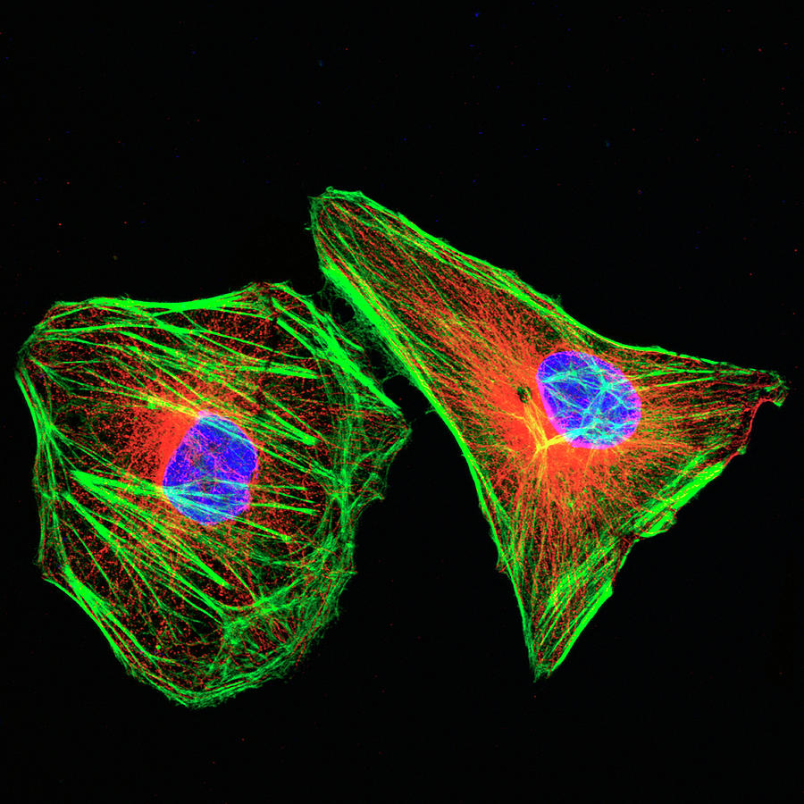 Hela Cervical Cancer Cells Photograph by Winship Cancer Institute At Emory University/national Cancer Institute/science Photo Library