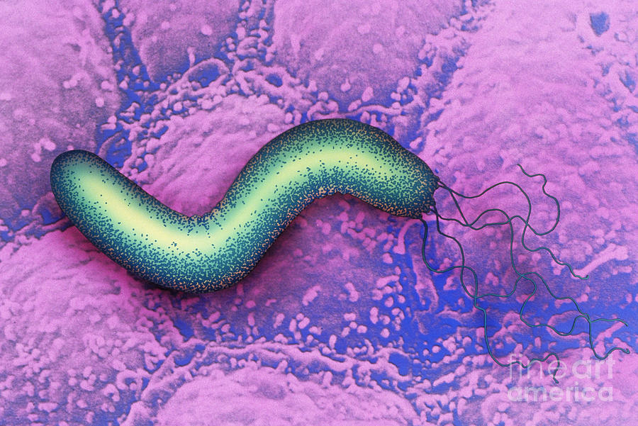 Bacteria Photograph - Helicobacter Pylori by Chris Bjornberg