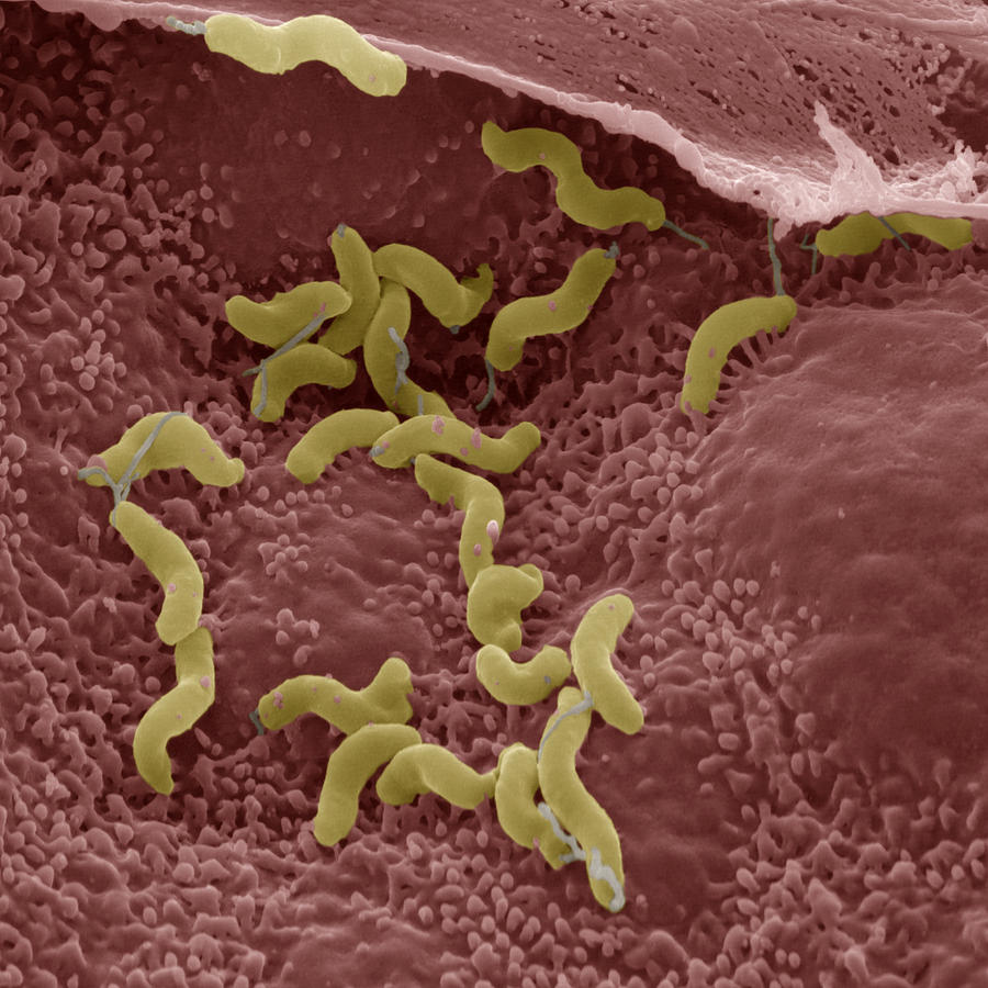 Helicobacter Pylori Photograph by Eye of Science