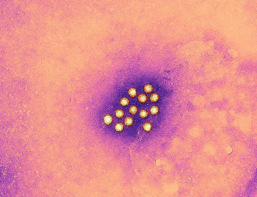 Hepatitis A Virus Particles Photograph by Ami Images/science Photo Library