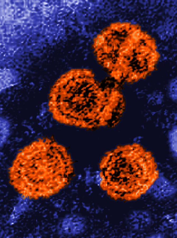 Hepatitis B Virus, Sem Photograph by Science Source