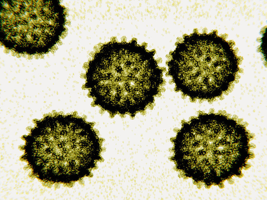 Hepatitis C Viruses, 3d Illustration Photograph by Juan Gaertner