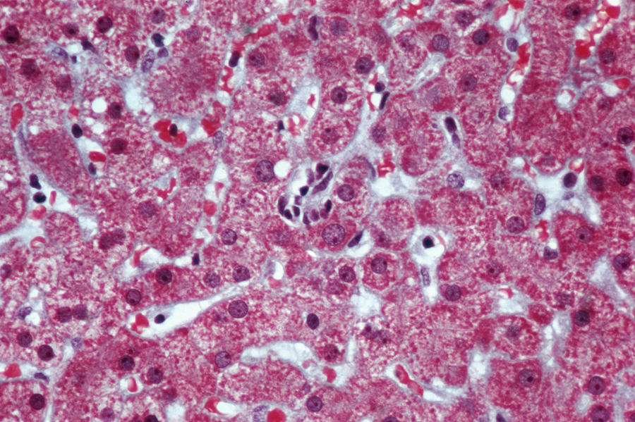 Hepatocytes Liver Lm Photograph by Marshall Sklar