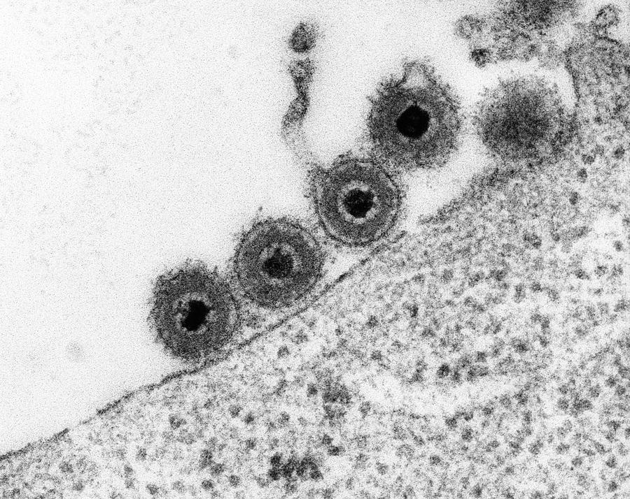 Herpes Simplex Virus Photograph by Dennis Kunkel Microscopy/science Photo Library