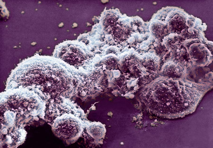 Как выглядит вирус герпеса под микроскопом фото