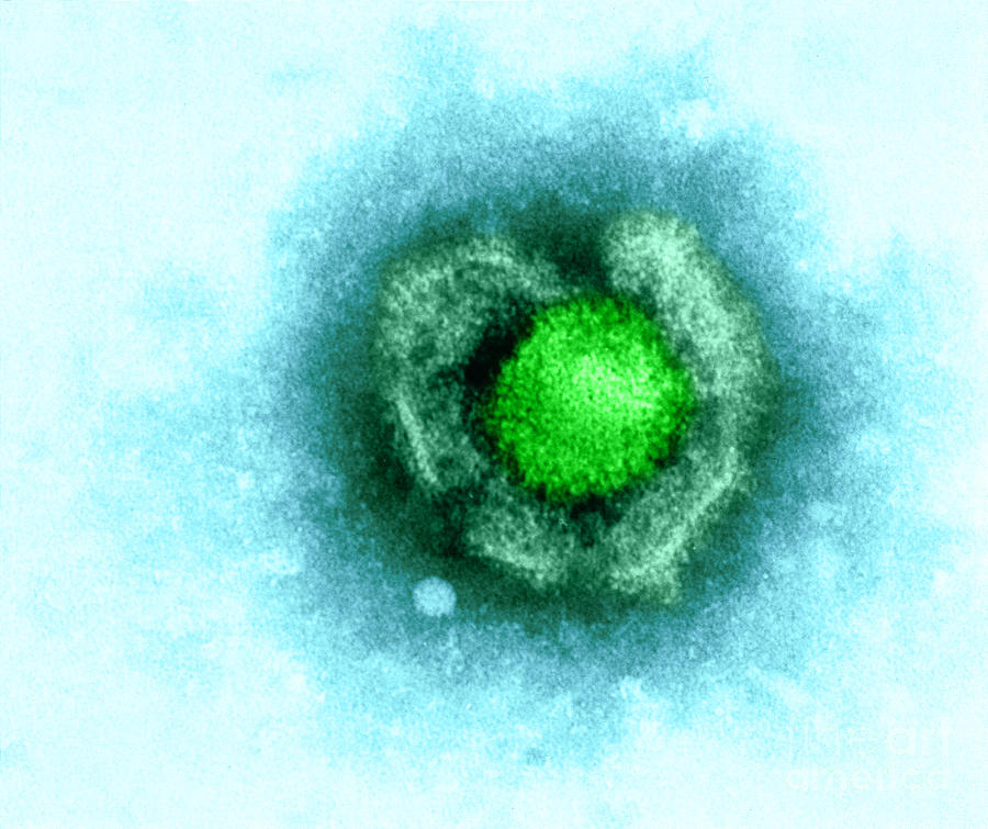 Barr Photograph - Herpes Simplex Virus by Kwangshin Kim