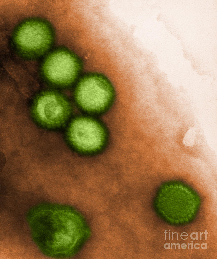 Herpes Simplex Virus Tem Photograph by Biophoto Associates