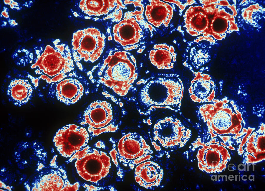 Herpes Simplex Virus Tem Photograph by Scott Camazine