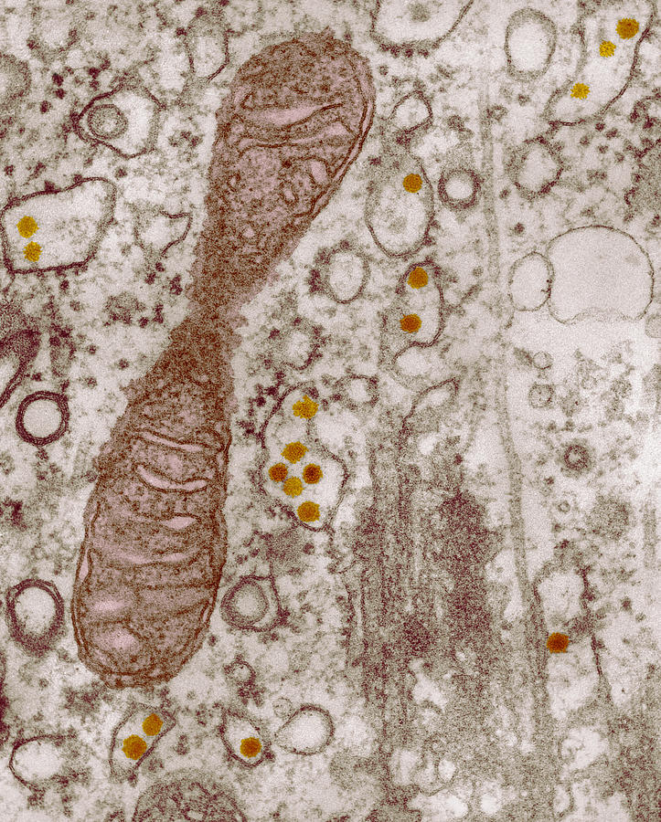 Herpes Simplex Viruses Photograph by Eye of Science