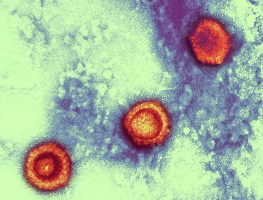 Herpes Virus Particles Photograph by Ami Images