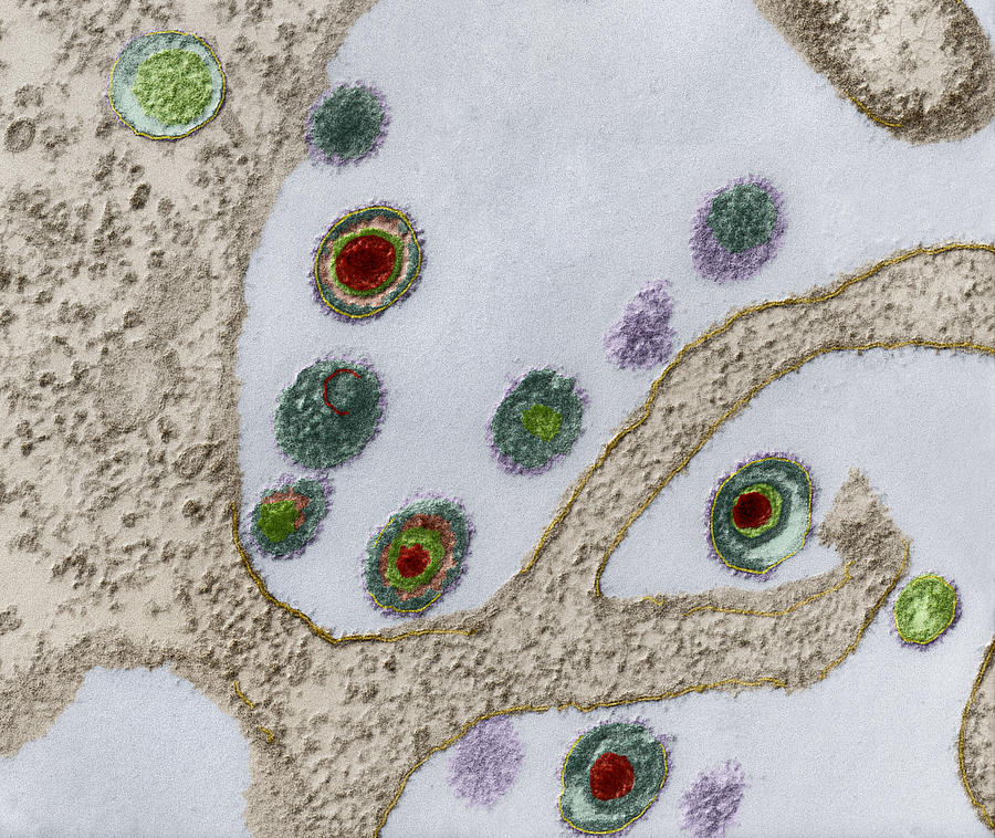 Herpes Virus, Tem Photograph by Eye of Science
