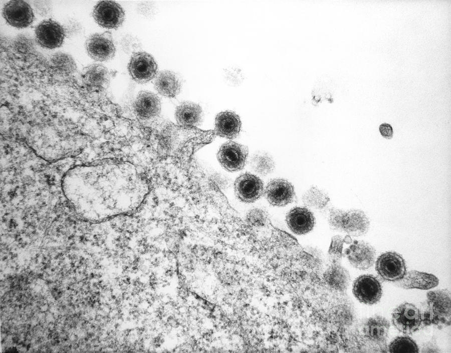 Herpesvirus 6 Photograph by David M Phillips Fine Art America