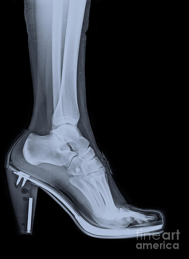 high heel shoe X-ray Photograph by Guy Viner