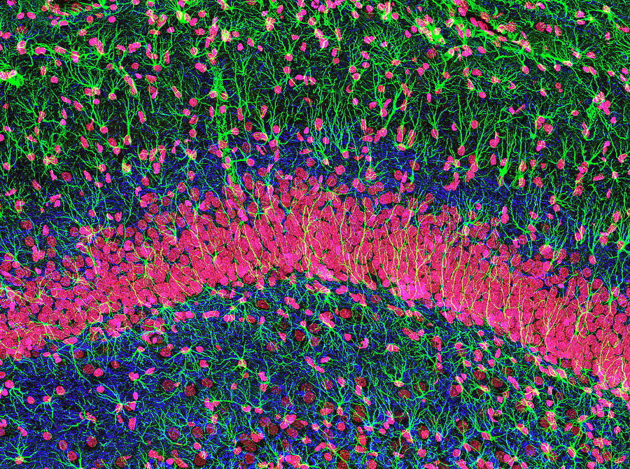 Hippocampus Brain Tissue Photograph by Thomas Deerinck, Ncmir