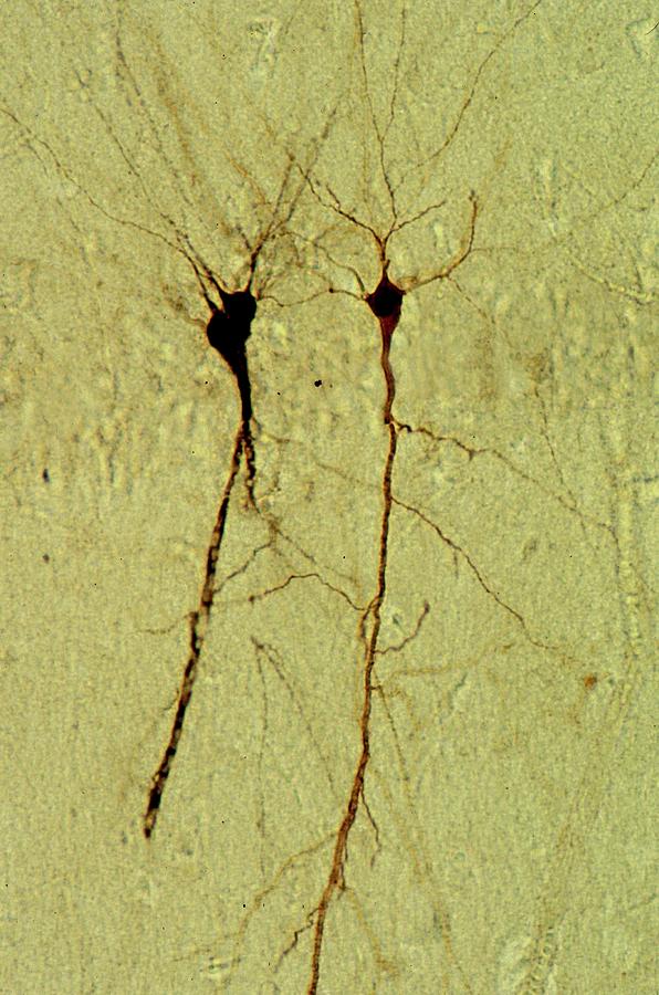 Hippocampus Pyramidal Neurons Photograph by Dennis Kunkel Microscopy/science Photo Library