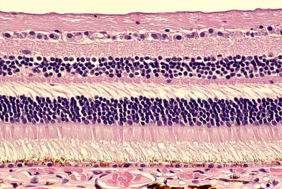 Histology Of Normal Retina Photograph by Ralph C. Eagle Jr.