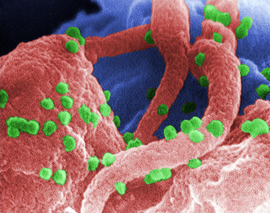 Hiv-1, Human Immunodeficiency Virus, Sem Photograph by Science Source