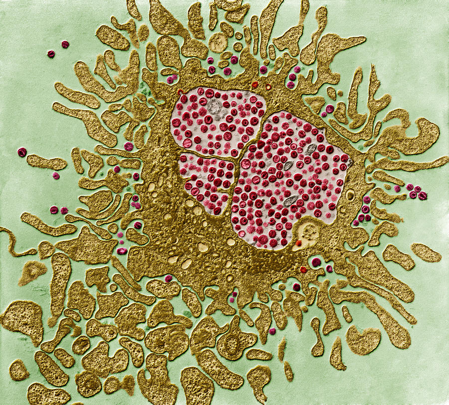 Hiv And Lymphocyte, Tem Photograph by Eye of Science | Pixels