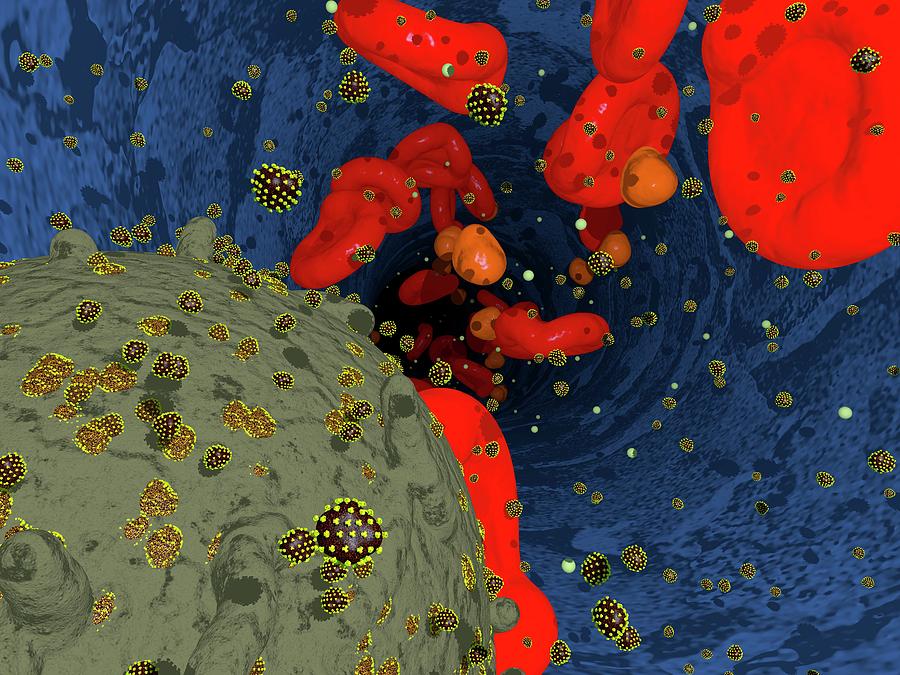 Hiv In Bloodstream Photograph by Thomas Fester/science Photo Library