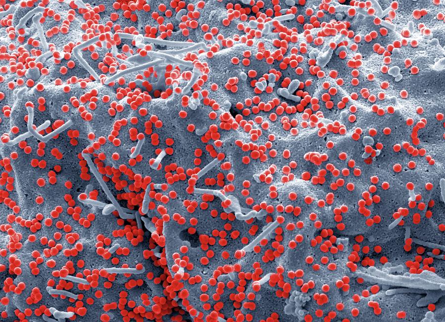 Hiv Infected 293t Cell Photograph By Steve Gschmeissnerscience Photo