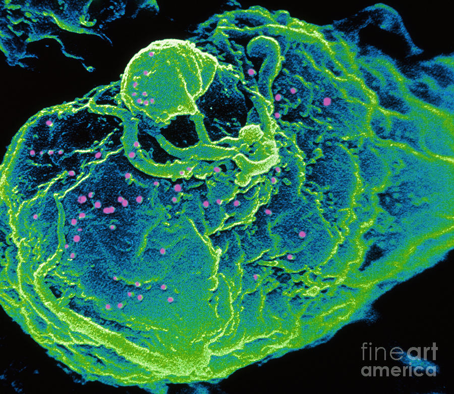 Hiv Infected T-cell Photograph by Scott Camazine