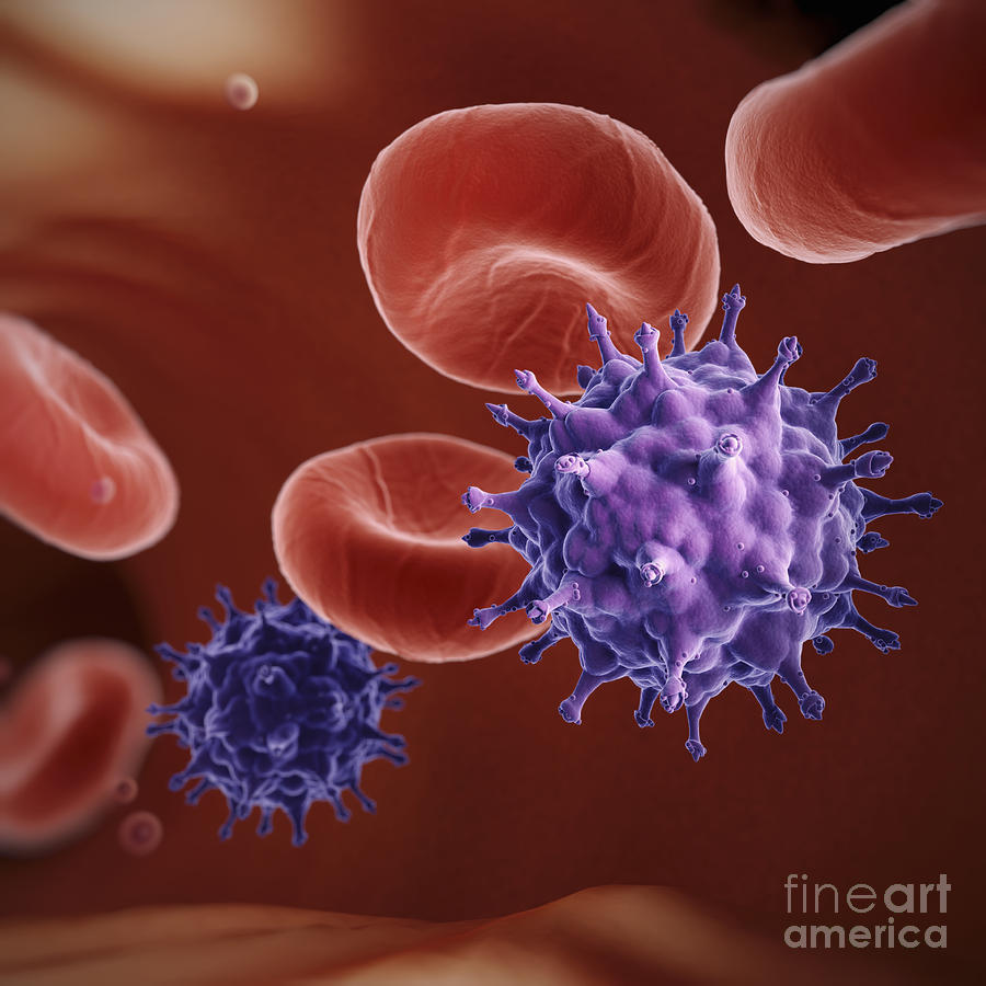 Hiv Infection Photograph by Science Picture Co