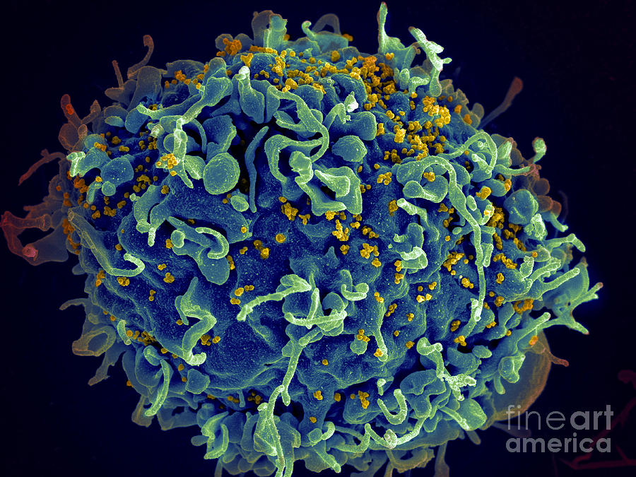 Hiv T Cell Under Attack Sem Photograph by Science Source