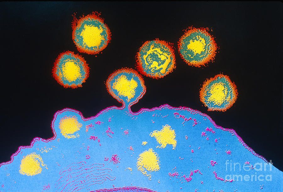 Tem Photograph - Hiv Virus Budding From T4 Lymphocyte by Chris Bjornberg