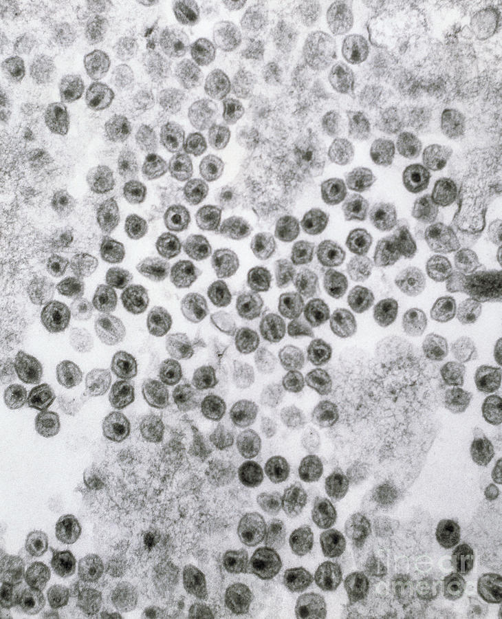 Hiv Virus Photograph by David M. Phillips