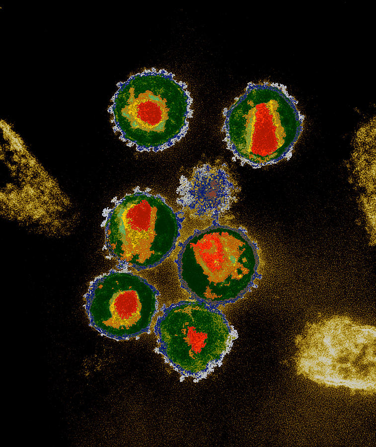 Hiv Viruses Photograph by Eye of Science