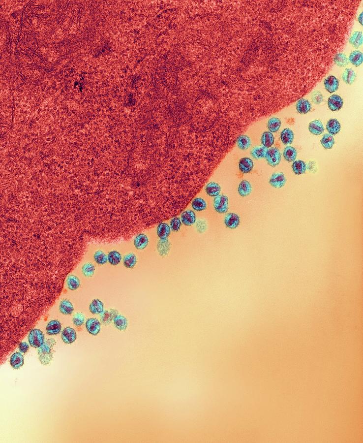 Acquired Immune Deficiency Syndrome Photograph - Hiv Viruses Infecting A Cell by Ami Images/dartmouth College - Louisa Howard