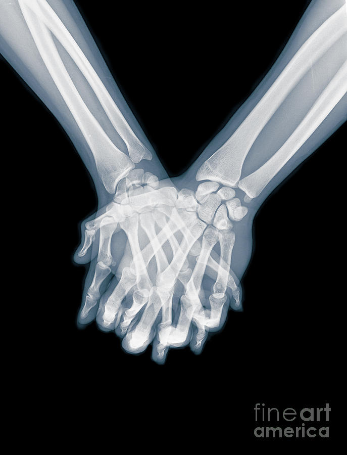 Holding Hands x-ray Photograph by Guy Viner