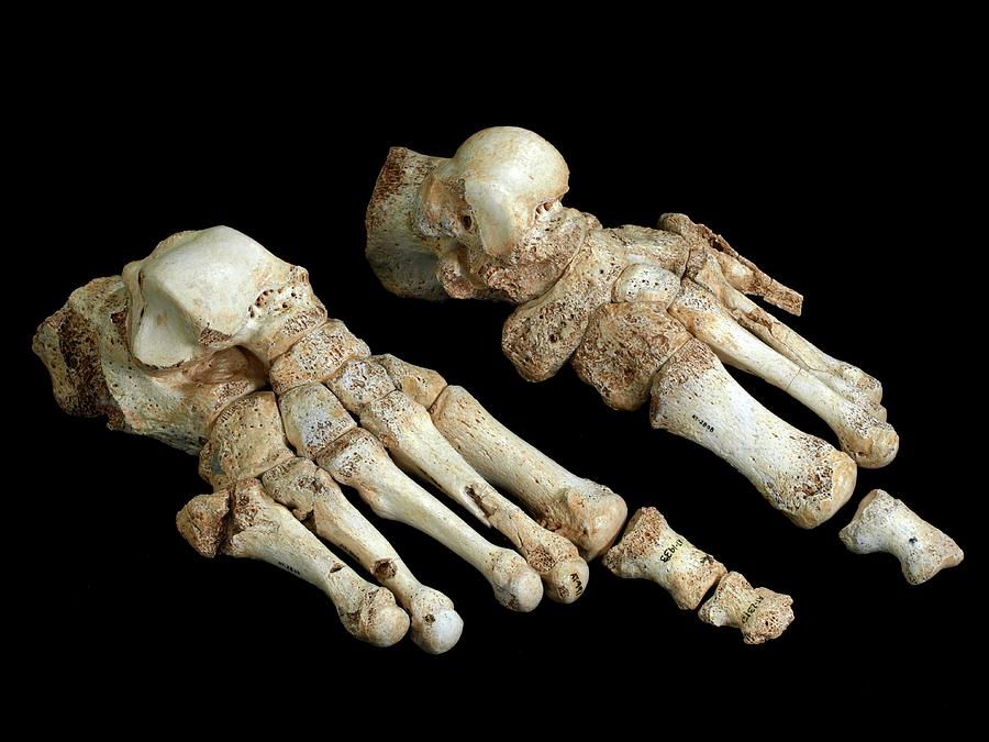 Paleolithic Photograph - Homo Heidelbergensis Fossil Foot Bones by Javier Trueba/msf