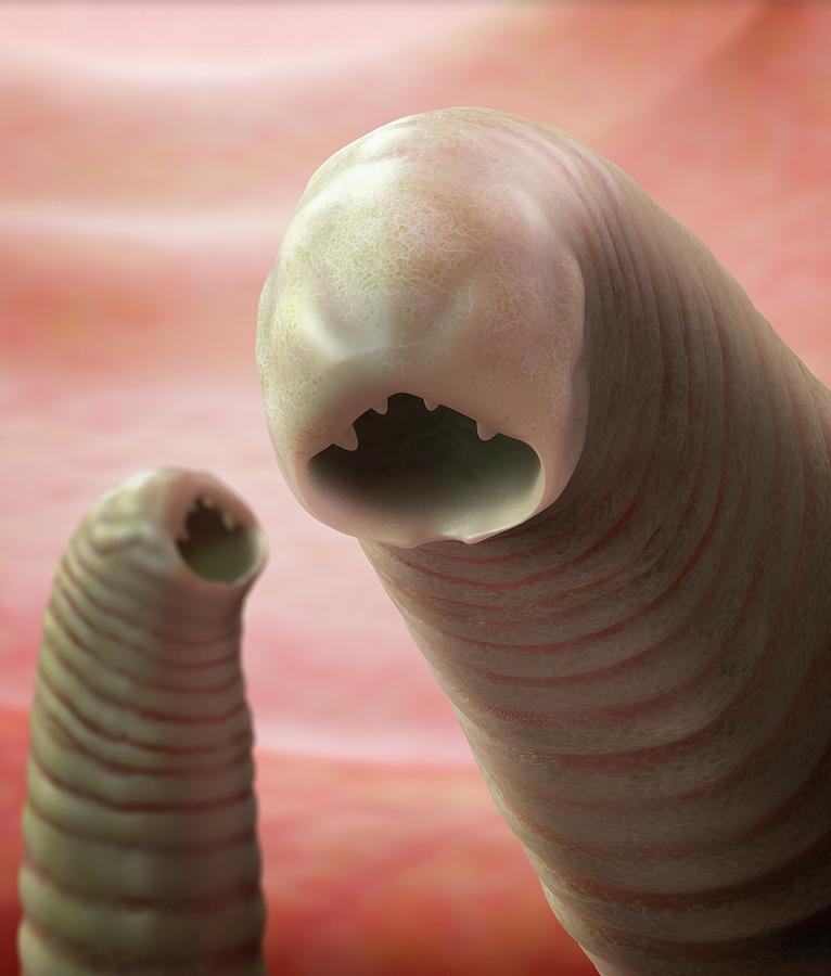 Hookworms by Tim Vernon / Science Photo Library