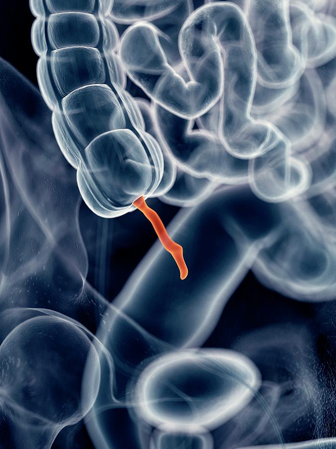 Human Appendix by Science Photo Library