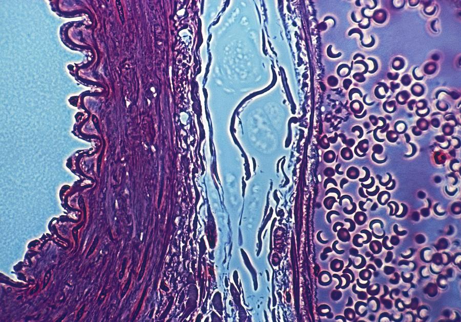 Human Artery And Vein, Lm Photograph by Joseph F. Gennaro Jr.