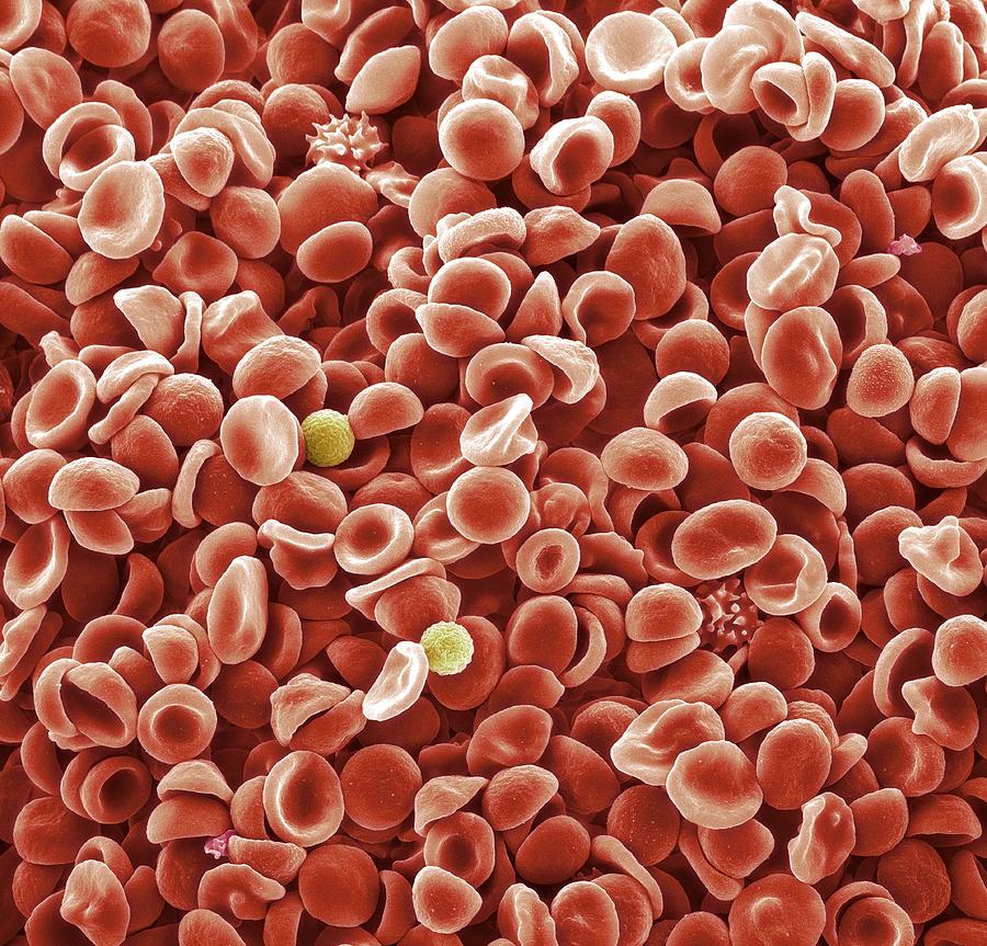 Human blood cells, SEM Photograph by Science Photo Library - STEVE GSCHMEISSNER