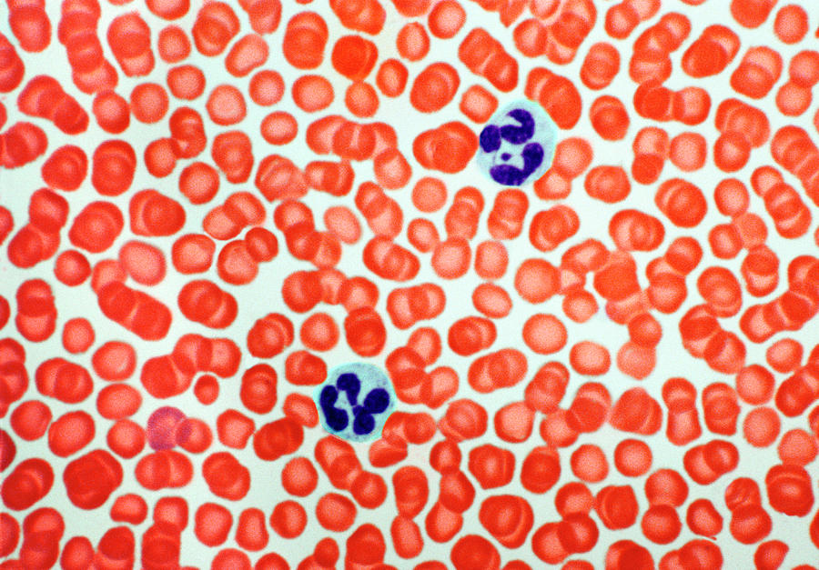Human Blood Cells Photograph by Steve Gschmeissner